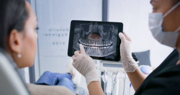 Licensed Tooth Extraction service in Statesville, NC - Smile Center Dentistry